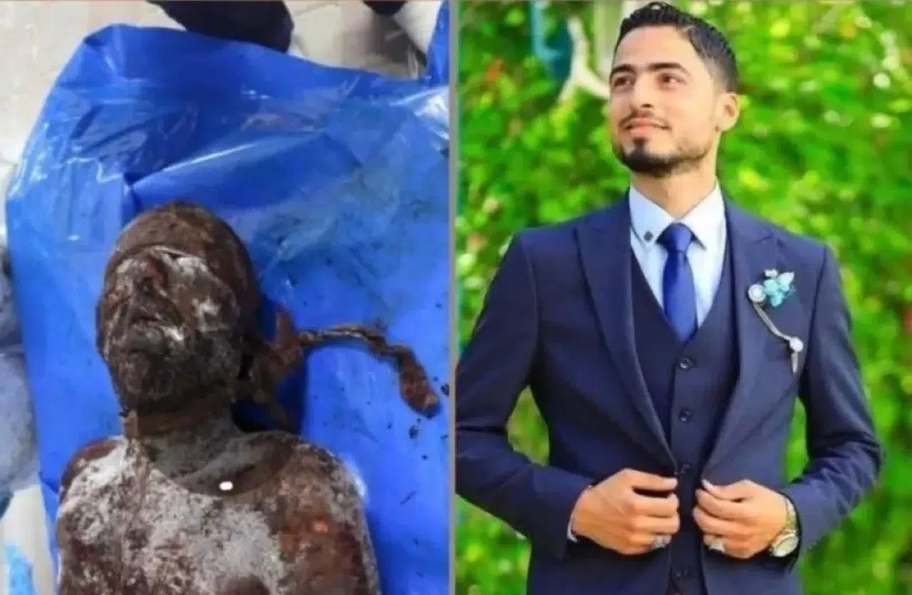 İŞTE SİYONİST VE SOYKIRIMCI İSRAİL'İN YAPTIĞI İNANILMAZ VAHŞET!