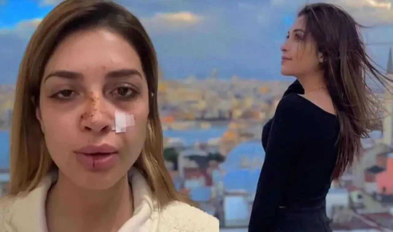 ÜNLÜ ŞARKICI AHSEN ERTOSUN’A SOKAKTA ŞİDDET UYGULANDI!