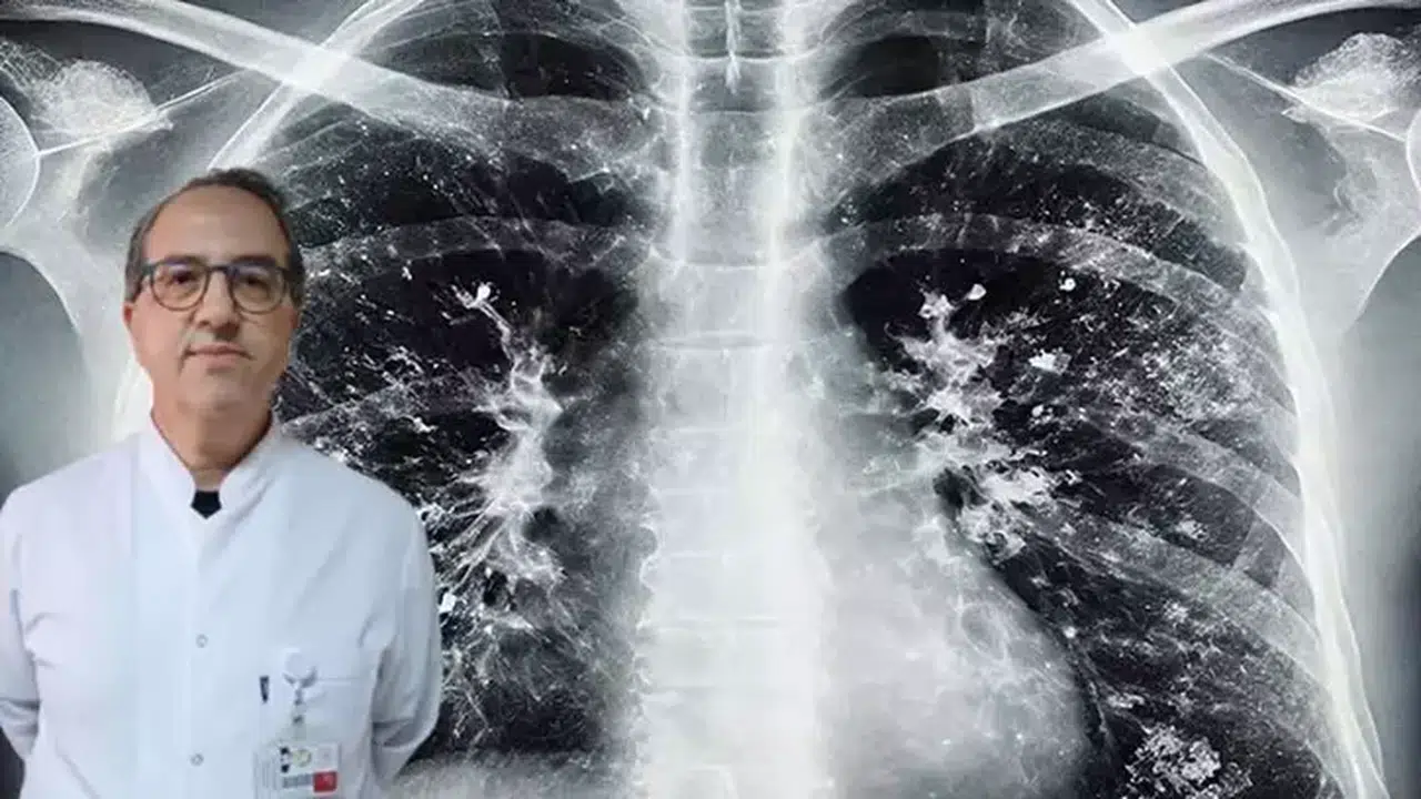 PROF.DR.ŞENER "SÜPER ENFEKSİYON" UYARISI YAPARAK "AŞI OLUN!" DEDİ!