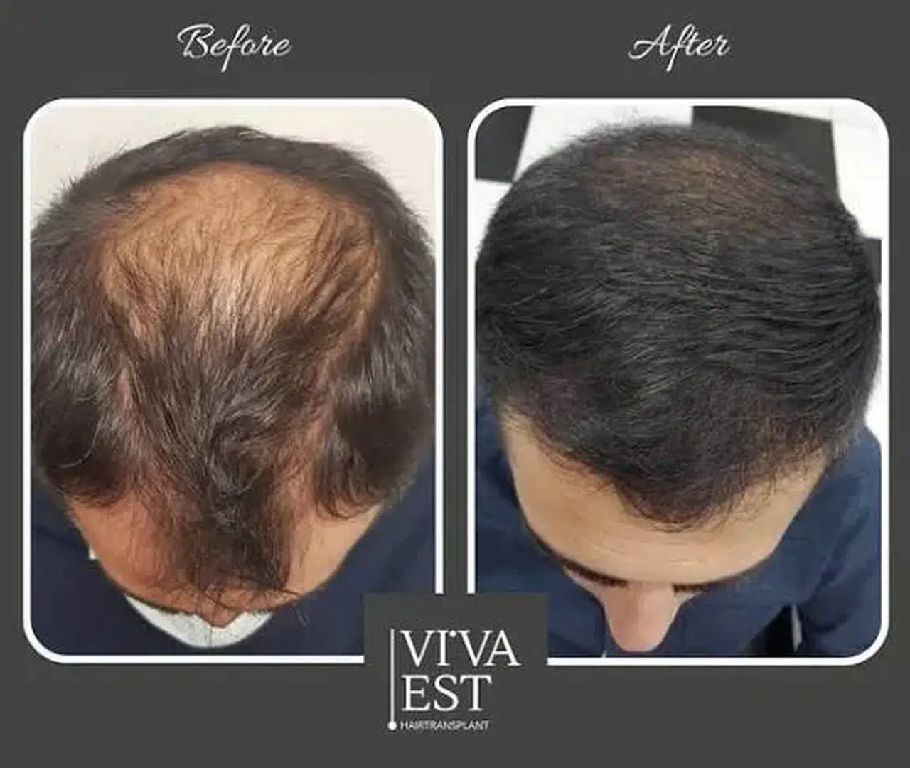 YAKLAŞIK 2 MİLYAR ERKEK BU ÜRÜNÜN SONUÇLARINI BEKLİYOR!