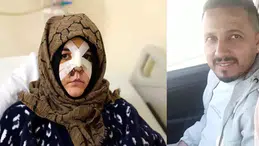 BOŞANMA AŞAMASINDAKİ EŞİNİ ÇARPTIĞI KALDIRIM TAŞI SİLAH SAYILDI!