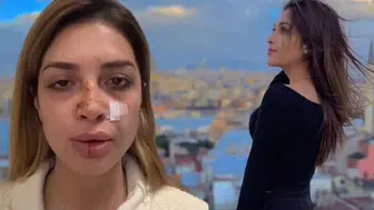 ÜNLÜ ŞARKICI AHSEN ERTOSUN’A SOKAKTA ŞİDDET UYGULANDI!