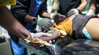 FİLİSTİNLİ ÇOCUK HASTANEYE  GİDERKEN EKMEĞİNİ BIRAKMADI!