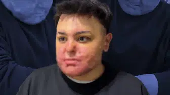 TALİHSİZ ENGİN FELAKETİ YAŞADIĞI BERBER DÜKKANINDA ÇALIŞIYOR!