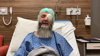 CÜBBELİ AHMET HOCA’NIN SOL GÖZÜNE NE OLDU?