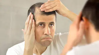 FLAŞ! FLAŞ! FLAŞ! SAÇ DÖKÜLMESİ O BİTKİ İLE TARİHE Mİ KARIŞIYOR?