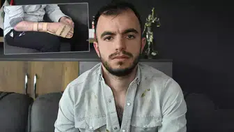 BAŞINA METAL PARÇA SAPLANAN GENÇ TAZMİNAT KAZANDI!