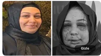 BİR KADIN BİR EŞ BİR ANNE BU HALE NASIL GETİRİLİR?