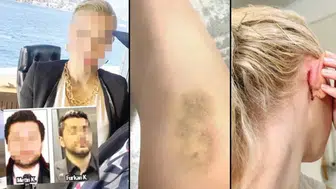 KADIN AVUKAT OFİSTE KİMLER TARAFINDAN DARP EDİLDİ?