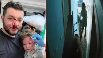 BABA İLE 14 AYLIK BEBEĞİ DARP İDDİASINDA YENİ BİR GELİŞME VAR!