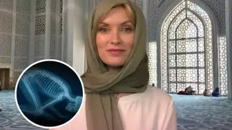 FLAŞ BİLGİ! SECDE DURUŞUNUN TIBBİ GERÇEĞİ ABD’Lİ PROFESÖRÜ MÜSLÜMAN YAPTI!