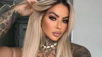 ÜNLÜ FENOMEN ESTETİK AMELİYAT SONRASI HAYATINI KAYBETTİ!