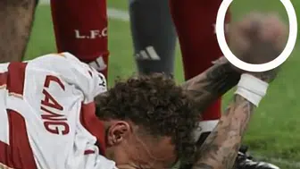 PARMAK KOPTU STAT DONDU! GALATASARAY’DA NOA LANG ŞOKU!