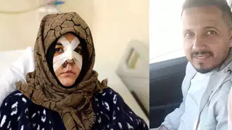 BOŞANMA AŞAMASINDAKİ EŞİNİ ÇARPTIĞI KALDIRIM TAŞI SİLAH SAYILDI!