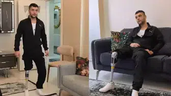 MOTOSİKLET KAZASINDA AYAĞINI KAYBEDEN GENCE HALK SAHİP ÇIKTI!