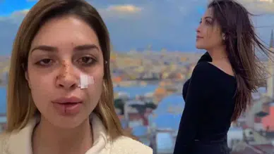 ÜNLÜ ŞARKICI AHSEN ERTOSUN’A SOKAKTA ŞİDDET UYGULANDI!