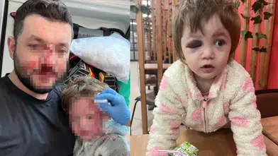 YALOVA’DA BABA İLE 14 AYLIK BEBEĞE SALDIRIDA YENİ GELİŞME!