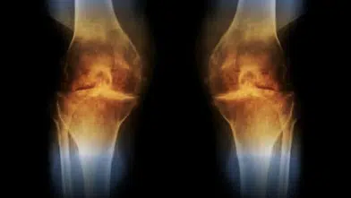 GELİŞTİRİLEN YENİ AŞI İLE DİZ KAPAĞI KIKIRDAĞI YENİDEN OLUŞUYOR!