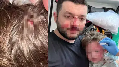 BABA İLE KÜÇÜK KIZININ DARP DURUŞMASININ İLK YAPILDI!