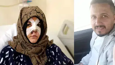 BOŞANMA AŞAMASINDAKİ EŞİNİ ÇARPTIĞI KALDIRIM TAŞI SİLAH SAYILDI!