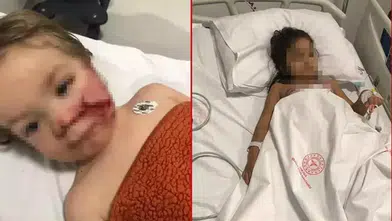 HAKİMDEN İKİ KARDEŞİ YARALAYAN PİTBUL İÇİN DİKKAT ÇEKİCİ KARAR!