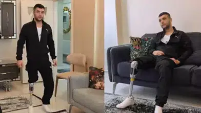 MOTOSİKLET KAZASINDA AYAĞINI KAYBEDEN GENCE HALK SAHİP ÇIKTI!