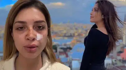 ÜNLÜ ŞARKICI AHSEN ERTOSUN’A SOKAKTA ŞİDDET UYGULANDI!