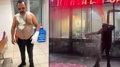 SİVAS'TA SOĞUK HAVAYI TEST ETMEK İSTERKEN KENDİSİNİ YAKTI!