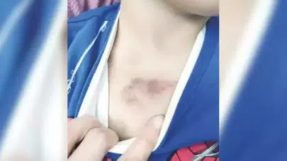 KREŞTE ÇOCUĞA ŞİDDET OLAYINDA 1 ŞÜPHELİ TUTUKLANDI!