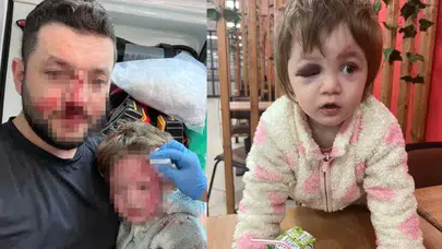 YALOVA’DA BABA İLE 14 AYLIK BEBEĞE SALDIRIDA YENİ GELİŞME!