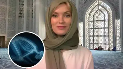 SECDE DURUŞUNUN TIBBİ GERÇEĞİ ABD’Lİ PROFESÖRÜ MÜSLÜMAN YAPTI!