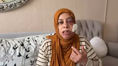 ELEKTRİKLİ BİSİKLET İLE KIRIK RÖGORA DÜŞTÜ! 14 DİKİŞ ATILDI!