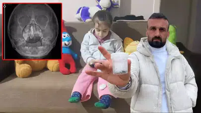 5 YAŞINDAKİ POLEN 2 YILDIR BURNUNDAKİ ZİNCİRLE YAŞAMIŞ!