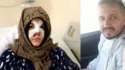 BOŞANMA AŞAMASINDAKİ EŞİNİ ÇARPTIĞI KALDIRIM TAŞI SİLAH SAYILDI!