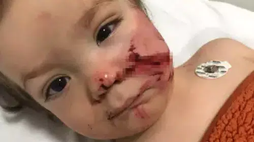 ANKARA'DA PİTBULL SALDIRDI! İKİ KARDEŞ SON ANDA YARALI KURTULDU!