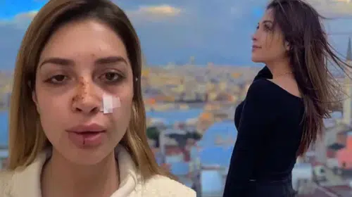 ÜNLÜ ŞARKICI AHSEN ERTOSUN’A SOKAKTA ŞİDDET UYGULANDI!