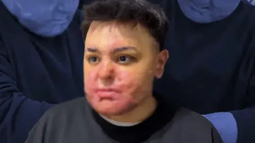 TALİHSİZ ENGİN FELAKETİ YAŞADIĞI BERBER DÜKKANINDA ÇALIŞIYOR!