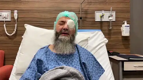 CÜBBELİ AHMET HOCA’NIN SOL GÖZÜNE NE OLDU?