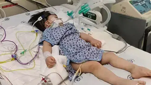 MİNİK ALPER’İN ANESTEZİ SONRASI KALBİ DURDU! ENTÜBE EDİLDİ!