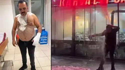 SİVAS'TA SOĞUK HAVAYI TEST ETMEK İSTERKEN KENDİSİNİ YAKTI!