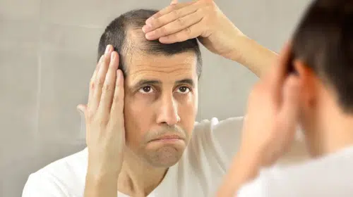 FLAŞ! FLAŞ! FLAŞ! SAÇ DÖKÜLMESİ O BİTKİ İLE TARİHE Mİ KARIŞIYOR?