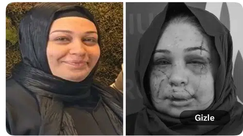 BİR KADIN BİR EŞ BİR ANNE BU HALE NASIL GETİRİLİR?