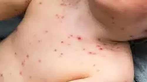 OKULDA ÇOCUĞU OLAN ANNE VE BABALARA ÖNEMLİ UYARI!