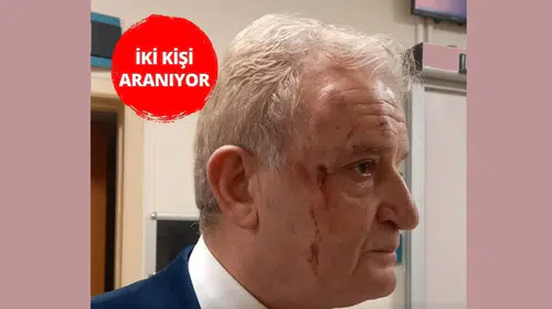 GAZETECİ HAKKI SAĞLAM ESKİŞEHİR'DE DARP EDİLDİ!