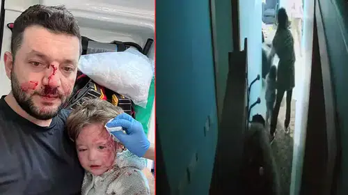 BABA İLE 14 AYLIK BEBEĞİNİN DARP İDDİASINDA YENİ GELİŞME!