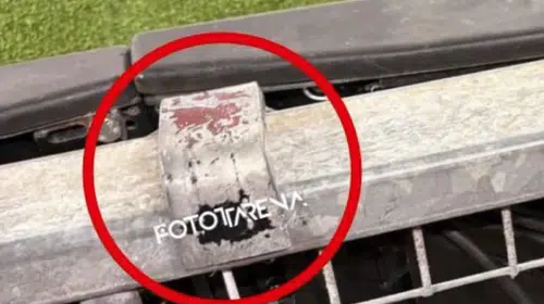 SKANDALIN ADI: STADYUM İHMALİ! NOA LANG’IN PARMAĞI KOPTU! UEFA NEREDE?