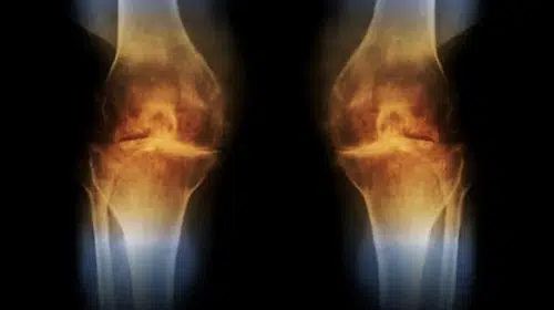 GELİŞTİRİLEN YENİ AŞI İLE DİZ KAPAĞI KIKIRDAĞI YENİDEN OLUŞUYOR!