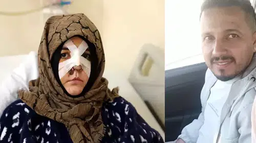 BOŞANMA AŞAMASINDAKİ EŞİNİ ÇARPTIĞI KALDIRIM TAŞI SİLAH SAYILDI!