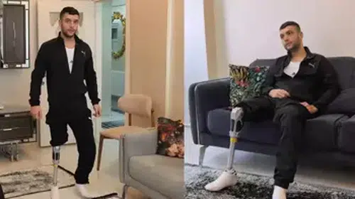 MOTOSİKLET KAZASINDA AYAĞINI KAYBEDEN GENCE HALK SAHİP ÇIKTI!