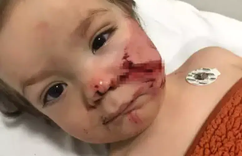 ANKARA'DA PİTBULL SALDIRDI! İKİ KARDEŞ SON ANDA YARALI KURTULDU!